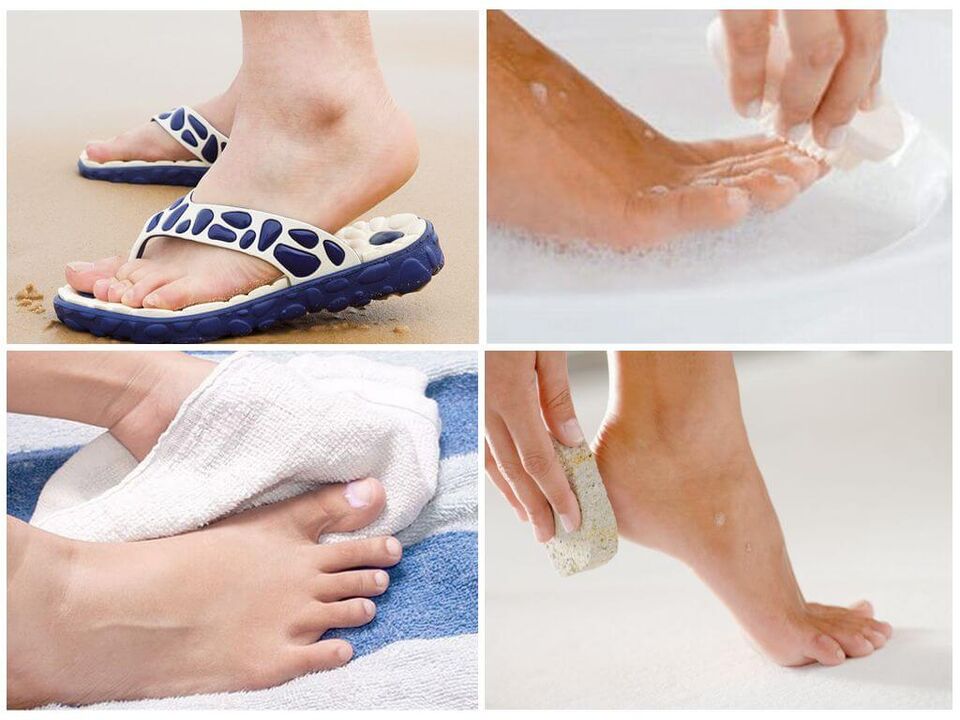 La prévention de l'onychomycose comprend l'hygiène des pieds, l'utilisation d'objets personnels et des pédicures en temps opportun