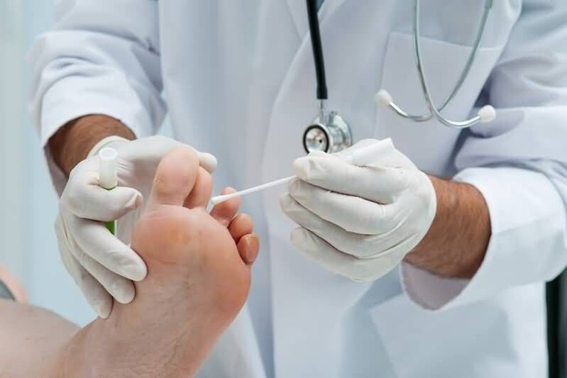 Si vous présentez des symptômes de mycose des ongles des pieds, vous devriez consulter un dermatologue ou un mycologue. 